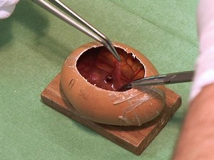 The In ovo CAM-assay as a Xenograft Model for Sarcoma