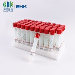 [Hot Item] Pbs Sampling Swab - Phosphate Buffer Saline Sampling Swab - Collecting and Transportation 10 Ml