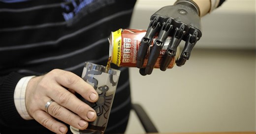 Slimme robothand kan zelf denken: ideaal voor mensen met een geamputeerde arm