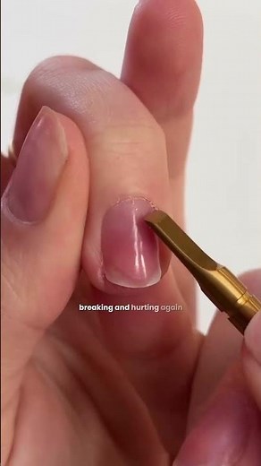How to Fix a Broken Nail Properly | Prevent Splitting, Peeling & Further Nail Damage