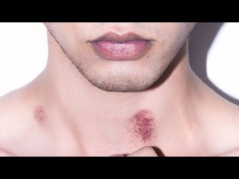 HOW TO GIVE A HICKEY EASIEST METHOD EVER