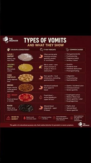 Vomiting? 🤢 | #health #medicine #mbbs #education #viral #shorts #study #students #doctor #explore