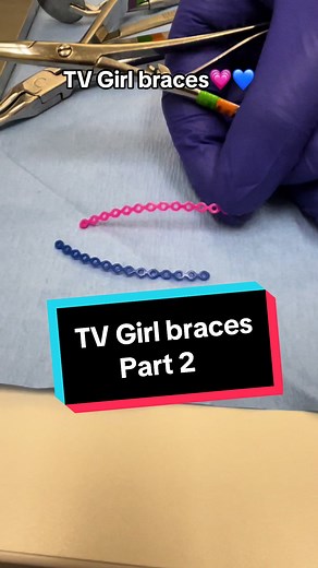 Rocking TV Girl Braces with Power Chains: A Colorful Journey