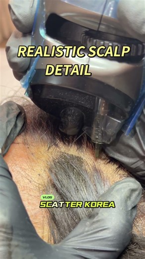Parting Line Transformation #Scatter #IndiaHairCare #SMPIndia #ScalpArt #HairParting #RoboticMotor
