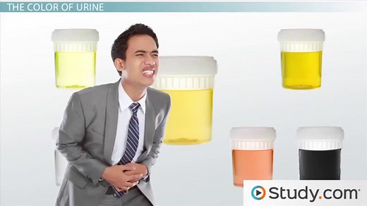 You must c C reate an account to continue watching