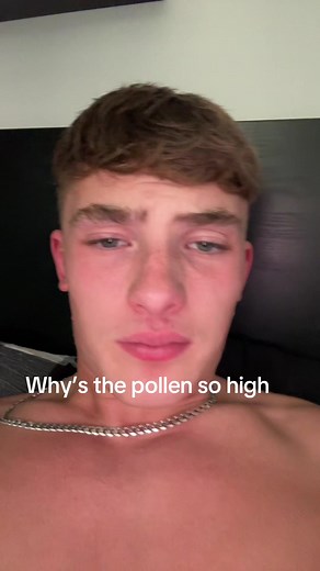 Understanding Hay Fever Symptoms This Season