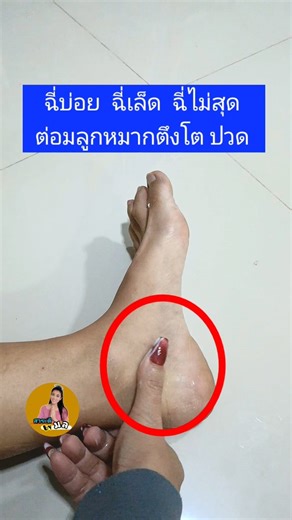 ฉี่บ่อยฉี่ไม่สุดฉี่เล็ดนวดเบาๆอาการจะดีขึ้นเอง #ฉี่บ่อยฉี่เล็ดต่อมลูกหมากโต #จุดสะท้อนกระเพาะปัสสาวะ #สาระดีbyมล | มล mol