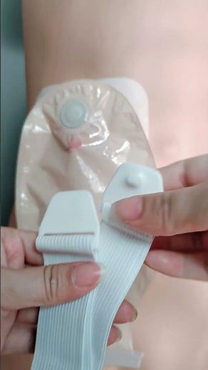 Do you know how to wear a stoma belt correctly?