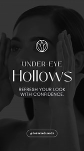 Under-eye hollows can make you look tired, even when you’re well-rested. They often result from: ✔️ Volume loss due to aging ✔️ Genetics ✔️ Thinning skin Treatments like dermal fillers and skin boosters can help restore lost volume, improve hydration, and brighten the under-eye area. At The Skin Clinic, we create customized plans to address your unique concerns, leaving you looking refreshed and revitalized. Don’t let under-eye hollows hold you back—explore solutions with our team of experienced