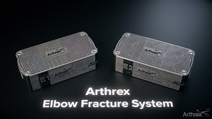 The Arthrex Elbow Fracture Plating System