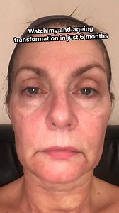 Get your hands on retinoids – the gold standard for anti-ageing, and see visible results in 8-12 weeks | Dermatica | Facebook