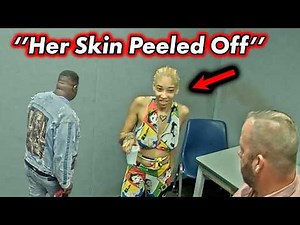 Meth Parents Asked Why Their Child's Skin Is Peeling Off
