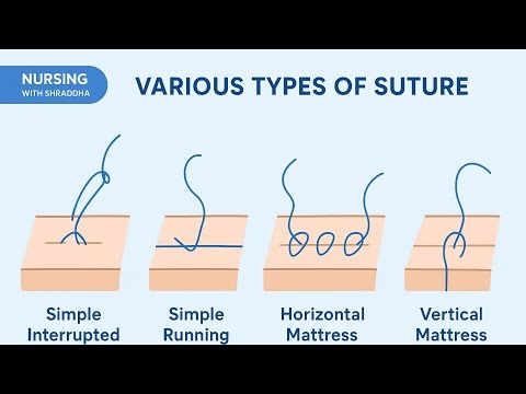 All Types of Sutures Explained with Examples Nursing Exam High-Yield Topic!🪡🧵#nursingwithshraddha 💉🩺