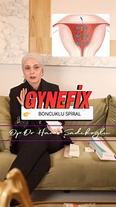 GYNEFİX ( Boncuklu spiral ) Rahim duvarına sabitlendiği için sık sık spirali kayan hastalarda özellikle tercih sebebidir. Yüksek koruyuculuk oranına sahiptir ( �,4 ) 5 yıl koruyuculuğu devam eder. ✔️ Adet kanamanızı artırmaz ✔️ Kasık ağrısına neden olmaz ✔️ Enfeksiyon riskini artırmaz ✔️Etkili ve güvenli bir korunma yöntemidir Sorularınız için DM👉 Detaylı bilgi ve randevu için ☎️0542 400 97 00 Daha fazla bilgi için sayfamı takip etmeyi unutmayın‼️ @drhacersadikoglu Not: ürün ismi geçtiği için r