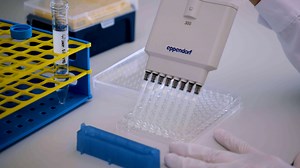 A Simple Pit Assay Protocol to Visualize and Quantify Osteoclastic Resorption In Vitro