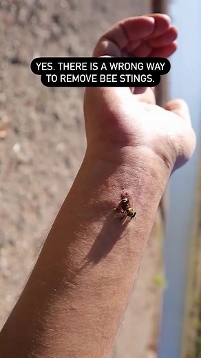 6.5K views · 19 reactions | Learn the CORRECT way to remove a bee sting  This is why you shouldn't use tweezers or try and pinch out the sting  This is how to remove a bee sting - the right way. As the weather warms up, and our little ones are running around outside, share this tip with another parent in case they ever need this tip #tinyhearts #tinyheartseducation #firstaid #parenting #beesting #beefirstaid #howtoremoveabeesting | Tiny Hearts Education | Facebook