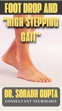 Foot Drop and High Stepping gait #footdrop #highsteppinggait #neuropathy #neurologistindehradun