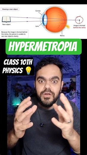 Hypermetropia kyun hota ha ? 👓 | Farsightedness Explained | Class 10 Science #physics