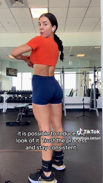 Natural Ways to Reduce Cellulite: Tips, Workouts, and More