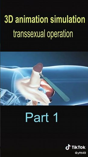 How things work | Gender reassignment surgery from male to female slowed version ( part 1 of 5)