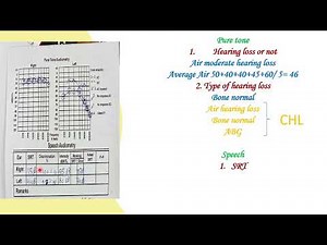 Audiology Ayman Basic 3c applied audiometry