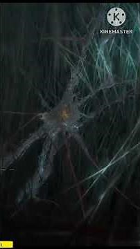 How the WATCHMAN device works ? #cardiology #heart #doctor #medicalstudent #hospitaltraining