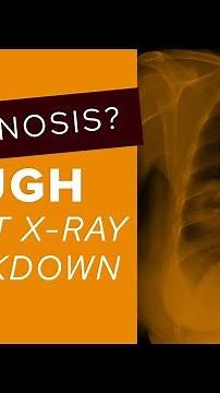 Chest X-Ray breakdown: female presents with cough