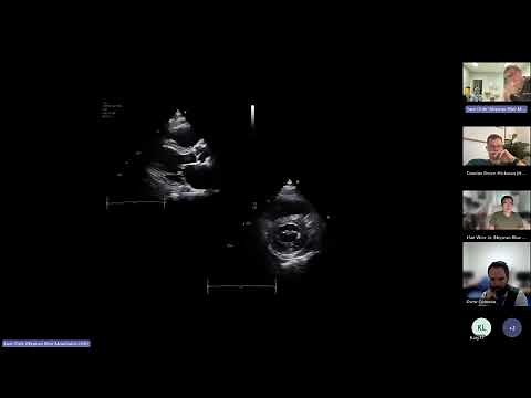 LV size, function and haemodynamic assessment