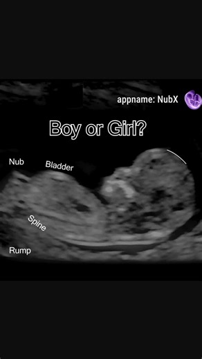 Can You Guess the Baby's Gender?