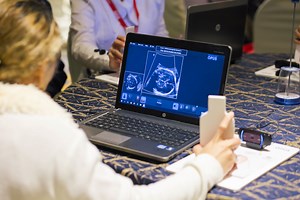 Volutracer OPUS - Optical Positioning Ultrasound Simulator -