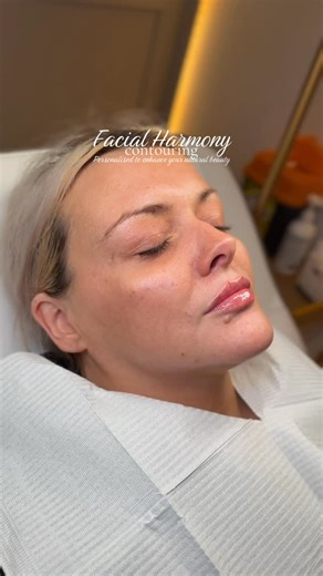 ENHANCE U AESTHETICS - APRIL KEMP on Instagram: "This transformation isn’t about changing features - it’s about balancing proportions, enhancing natural structure and restoring harmony to the face. Using strategic placement of filler, we enhanced my client key contour points to create a lifted, sculpted and more refreshed appearance while keeping her result soft and natural.💫 Each and every treatment is personal - personalised to you to enhance your natural beauty🌸 DM ‘CONTOUR’ and we can crea