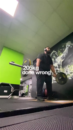 Overcoming Overeating: A Personal Journey