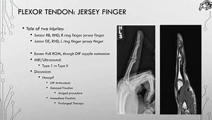 In-Season Tendon Injuries of the Athlete