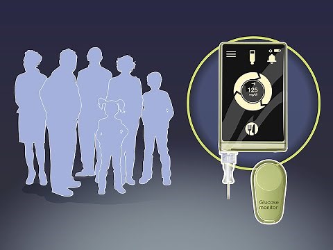 Bionic Pancreas in Type 1 Diabetes | NEJM