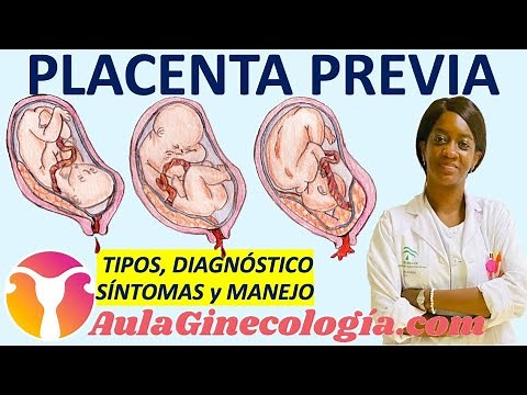 PLACENTA PREVIA: CLASIFICACIÓN, DIAGNÓSTICO, 🩸SÍNTOMAS🩸, MANEJO... - Ginecología y Obstetricia -