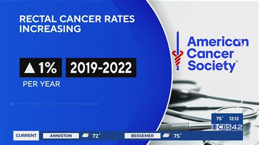 Rectal cancer rates increasing
