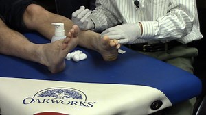 Needling the Extensor Hallucis Brevis