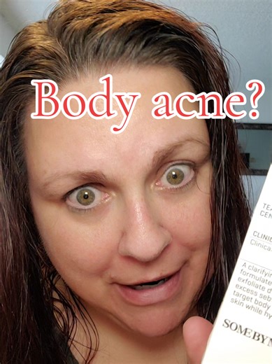 Pov: you have body acne and you are afraid to wear tank tops or take off your shirt. well summer is coming. take care of this now!! #springglowup #somebymi #skincareroutine #tiktokshoprestock #glassskin @somebymi.official_jp