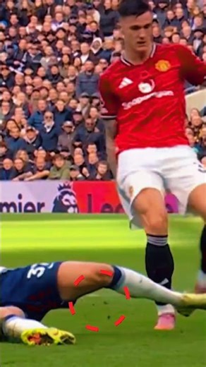 What is that coming out of this player's pants?||SM Bangla