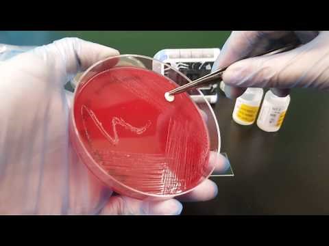 Microbiology: Anaerobic Nitrate Reduction Test