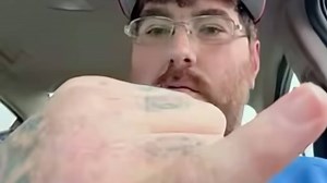 Who is Michael Phillips? The North Carolina man who claims to have the smallest penis in the world