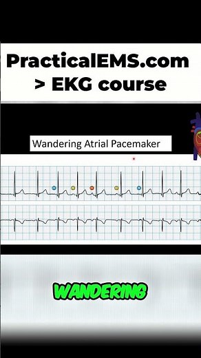 Wandering Atrial Pacemaker: Easily Identify This Dysrhythmia!