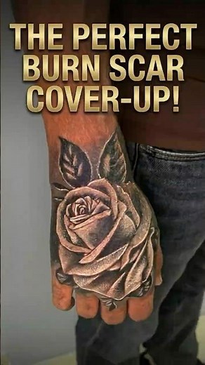 Burn Scar Cover-Up Tattoo 🌹 | Emotional Rose Tattoo Transformation | Black & Grey Realism