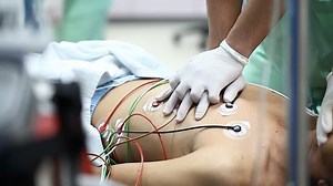 Cardiopulmonary Resuscitation Cpr Patient Stock Footage Video (100% Royalty-free) 13563821 | Shutterstock
