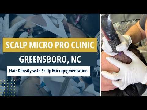 Hair Density with Scalp Micropigmentation | Scalp Micro Pro Clinic
