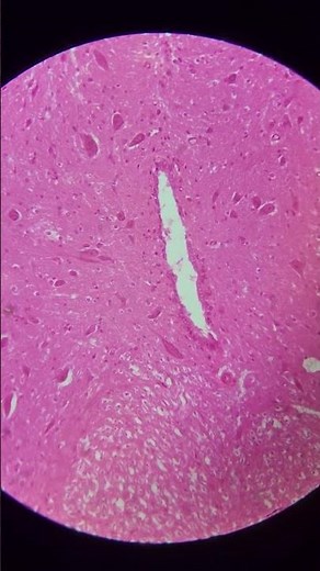 Transverse of spinal cord at 25x, 40x, 100x, 200x and 400x magnification | Under the microscope 🔬