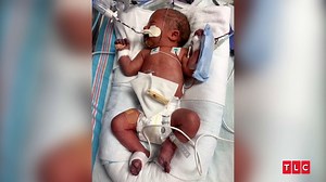 1.3M views · 3.8K reactions | "It's heartbreaking to see him like this." #LorenAndAlexei's baby is here early. | TLC | Facebook