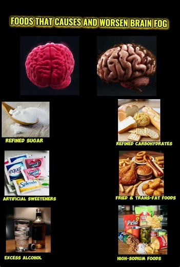 Foods That Cause Brain Fog | Avoid These for Better Focus & Mental Clarity. #short #brian