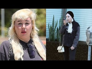 Amanda Bynes Looks UNRECOGNIZABLE After Losing 20 Pounds On Ozempic