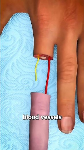 What To Do If Your Finger Gets Cut Off 🩸🖐️ | First Aid Tips